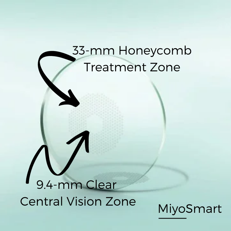 MiyoSmart Myopia Control Lenses.png